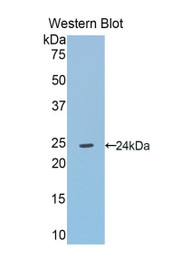 Western Blot; Sample: Recombinant protein.