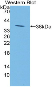 Western Blot; Sample: Recombinant protein.