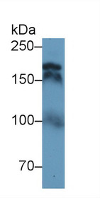 Western Blot; Sample: Human Serum; Primary Ab: 1µg/ml Rabbit Anti-Human TOP2 Antibody Second Ab: 0.2µg/mL HRP-Linked Caprine Anti-Rabbit IgG Polyclonal Antibody