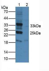 Western Blot; Sample. Lane1: Mouse Heart Tissue; Lane2: Rat Heart Tissue.