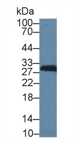 Western Blot; Sample: Mouse Heart lysate; Primary Ab: 2µg/ml Rabbit Anti-Rat CA2 Antibody Second Ab: 0.2µg/mL HRP-Linked Caprine Anti-Rabbit IgG Polyclonal Antibody