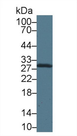 Western Blot; Sample: Mouse Heart lysate; Primary Ab: 1µg/ml Rabbit Anti-Mouse CA2 Antibody Second Ab: 0.2µg/mL HRP-Linked Caprine Anti-Rabbit IgG Polyclonal Antibody