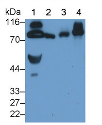 Western Blot; Sample: Recombinant protein.