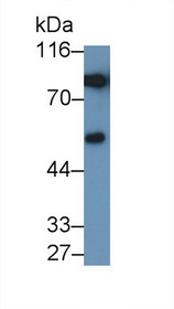 Western Blot; Sample: Recombinant protein.