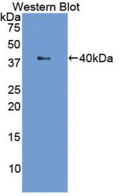 Western Blot; Sample: Recombinant protein.