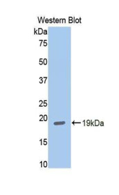 Western Blot; Sample: Recombinant protein.