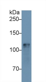 Western Blot; Sample: Mouse Heart lysate; Primary Ab: 1µg/ml Rabbit Anti-Mouse HK1 Antibody Second Ab: 0.2µg/mL HRP-Linked Caprine Anti-Rabbit IgG Polyclonal Antibody