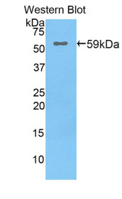 Western Blot; Sample: Recombinant protein.