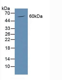 Western Blot; Sample: Mouse Brain Tissue.