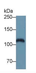Western Blot; Sample: Mouse Serum; Primary Ab: 1µg/ml Rabbit Anti-Mouse EGFR Antibody Second Ab: 0.2µg/mL HRP-Linked Caprine Anti-Rabbit IgG Polyclonal Antibody