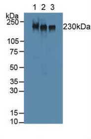 Western Blot; Sample: Lane1: Mouse Skeletal Muscle Tissue; Lane2: Rat Skeletal Muscle Tissue; Lane3: Mouse Heart Tissue.