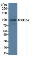 Western Blot; Sample: Rat Serum.