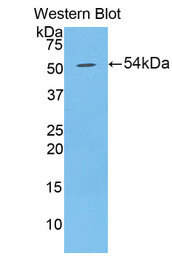 Western Blot; Sample: Recombinant protein.