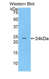 Western Blot; Sample: Recombinant protein.