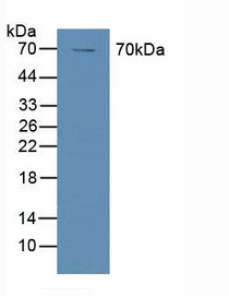 Western Blot; Sample: Human A431 Cells.