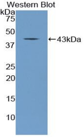Western Blot; Sample: Recombinant protein.