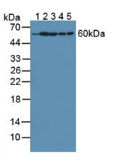 Western Blot; Sample: Lane1: Rat Liver Tissue; Lane2: Rat Brain Tissue; Lane3: Human Hela Cells; Lane4: Human HepG2 Cells; Lane5: Human A549 Cells.