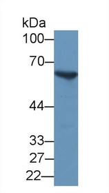 Western Blot; Sample: Mouse Spleen lysate; Primary Ab: 1µg/ml Rabbit Anti-Mouse G6PD Antibody Second Ab: 0.2µg/mL HRP-Linked Caprine Anti-Rabbit IgG Polyclonal Antibody