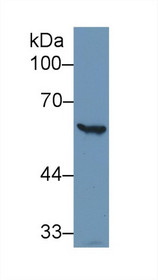 Western Blot; Sample: Human Hela cell lysate; Primary Ab: 1µg/ml Rabbit Anti-Human G6PD Antibody Second Ab: 0.2µg/mL HRP-Linked Caprine Anti-Rabbit IgG Polyclonal Antibody