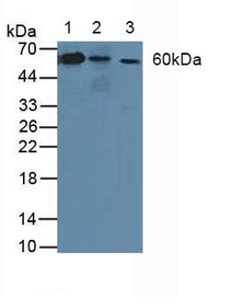 Western Blot; Sample: Lane1: Human Lung Tissue; Lane2: Human A-431 Cells; Lane3: Rat Skin Tissue.