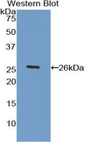 Western Blot; Sample: Recombinant protein.