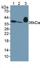Western Blot; Sample: Lane1: Mouse Serum; Lane2: Mouse Liver Tissue; Lane3: Rat Serum.