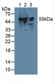 Western Blot; Sample: Lane1: Rat Liver Tissue; Lane2: Mouse RAW 264.7 Cells; Lane3: Rat Brain Tissue.