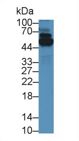 Western Blot; Sample: Human A549 cell lysate; Primary Ab: 5µg/ml Rabbit Anti-Mouse TrxR1 Antibody Second Ab: 0.2µg/mL HRP-Linked Caprine Anti-Rabbit IgG Polyclonal Antibody