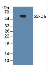 Western Blot; Sample: Human Urine.