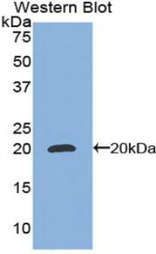 Western Blot; Sample: Recombinant protein.