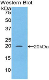 Western Blot; Sample: Recombinant protein.