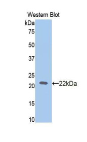Western Blot; Sample: Recombinant protein.