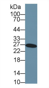 Western Blot; Sample: Human Liver lysate; Primary Ab: 2µg/ml Rabbit Anti-Human GSTa3 Antibody Second Ab: 0.2µg/mL HRP-Linked Caprine Anti-Rabbit IgG Polyclonal Antibody