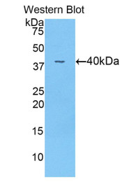 Western Blot; Sample: Recombinant protein.