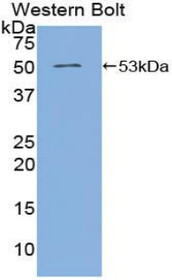 Western Blot; Sample: Recombinant protein.