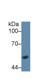 Western Blot; Sample: Rat Liver lysate; Primary Ab: 1µg/ml Rabbit Anti-Rat GCK Antibody Second Ab: 0.2µg/mL HRP-Linked Caprine Anti-Rabbit IgG Polyclonal Antibody