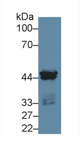 Western Blot; Sample: Human MCF7 cell lysate; Primary Ab: 2µg/ml Rabbit Anti-Rat CSNK1a1 Antibody Second Ab: 0.2µg/mL HRP-Linked Caprine Anti-Rabbit IgG Polyclonal Antibody