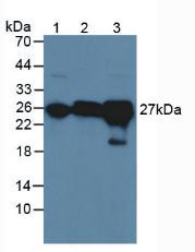 Western Blot; Sample: Lane1: Rat Serum; Lane2: Rat Brain Tissue; Lane3: Rat Liver Tissue.