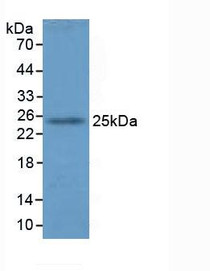 Western Blot; Sample: Mouse Lung Tissue.