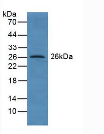 Western Blot; Sample: Human Lung Tissue.