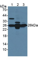 Western Blot; Sample: Lane1: Mouse Brain Tissue; Lane2: Mouse Liver Tissue; Lane3: Mouse Kidney Tissue.
