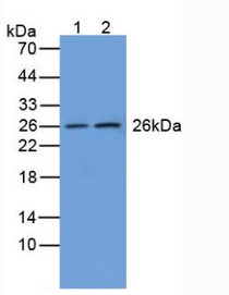 Western Blot; Sample: Lane1: Human Liver Tissue; Lane2: Rat Brain Tissue.