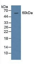 Western Blot; Sample: Rat Serum.