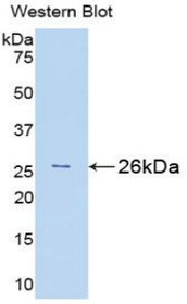 Western Blot; Sample: Recombinant protein.