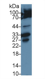 Western Blot; Sample: Human Hela cell lysate; Primary Ab: 2µg/ml Rabbit Anti-Rat CASP3 Antibody Second Ab: 0.2µg/mL HRP-Linked Caprine Anti-Rabbit IgG Polyclonal Antibody