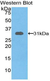 Western Blot; Sample: Recombinant protein.