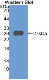 Western Blot; Sample: Recombinant protein.