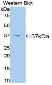 Western Blot; Sample: Recombinant protein.