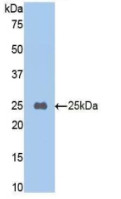 Western Blot; Sample: Recombinant TAFI, Mouse.