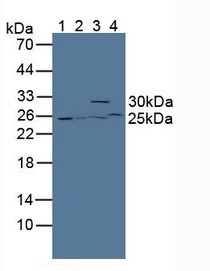 Western Blot; Sample: Lane1: Mouse Kidney Tissue; Lane2: Mouse Pancreas Tissue; Lane3: Mouse Lung Tissue; Lane4: Mouse Liver Tissue.